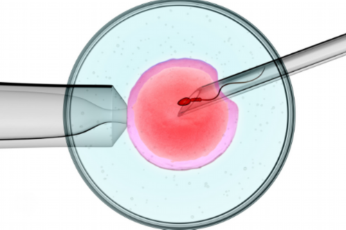 沈阳试管婴儿费用揭秘及移植后调理指南